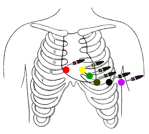 EKG, Methode, Prinzip, Untersuchung